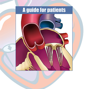 Heart Valve Disease a guide for patients