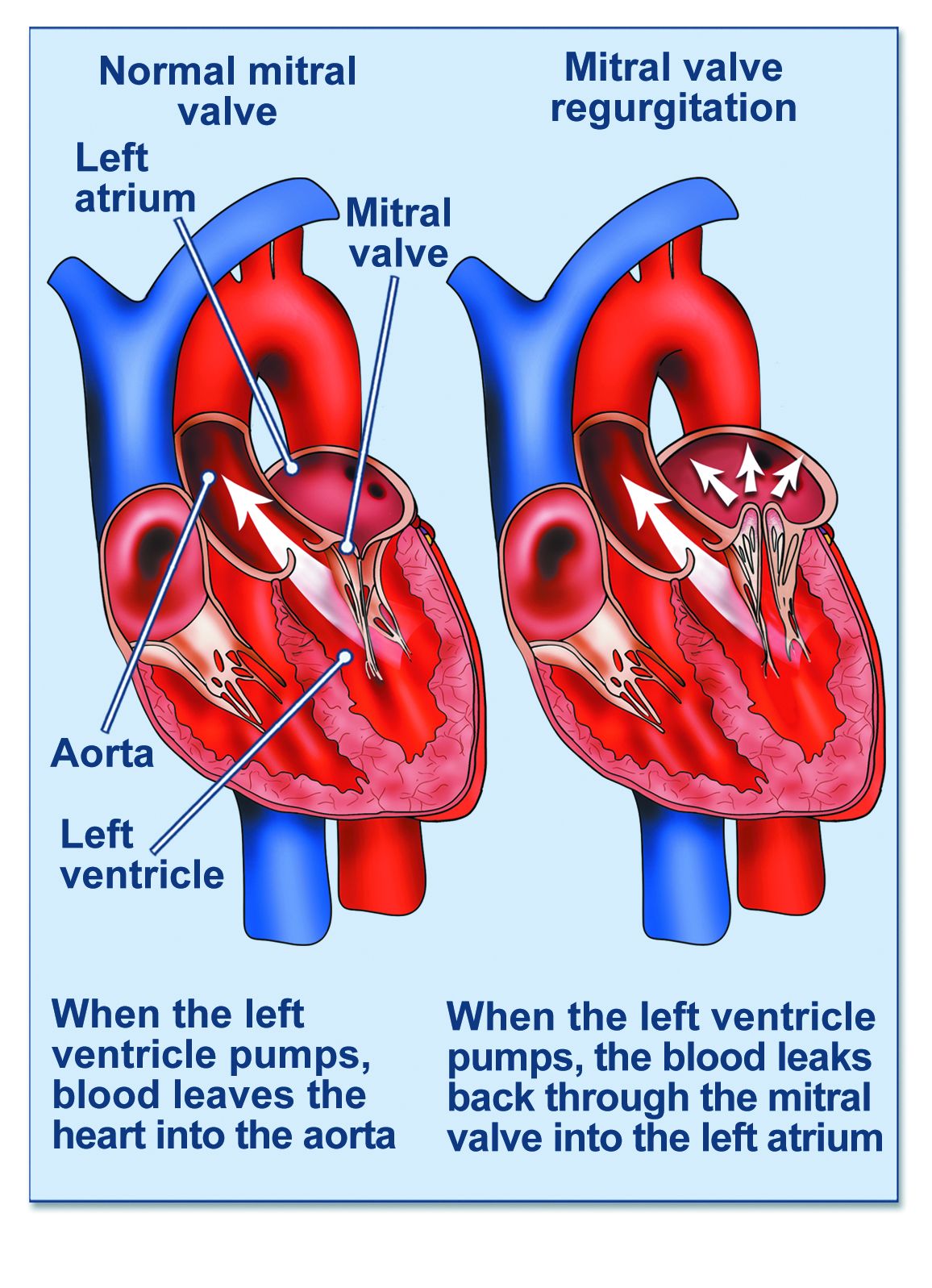 venous-disease